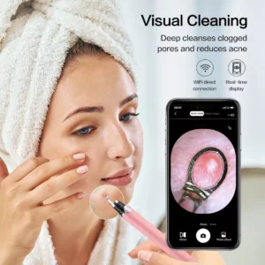 Blackhead Remover with Camera Blackhead Remover with Camera